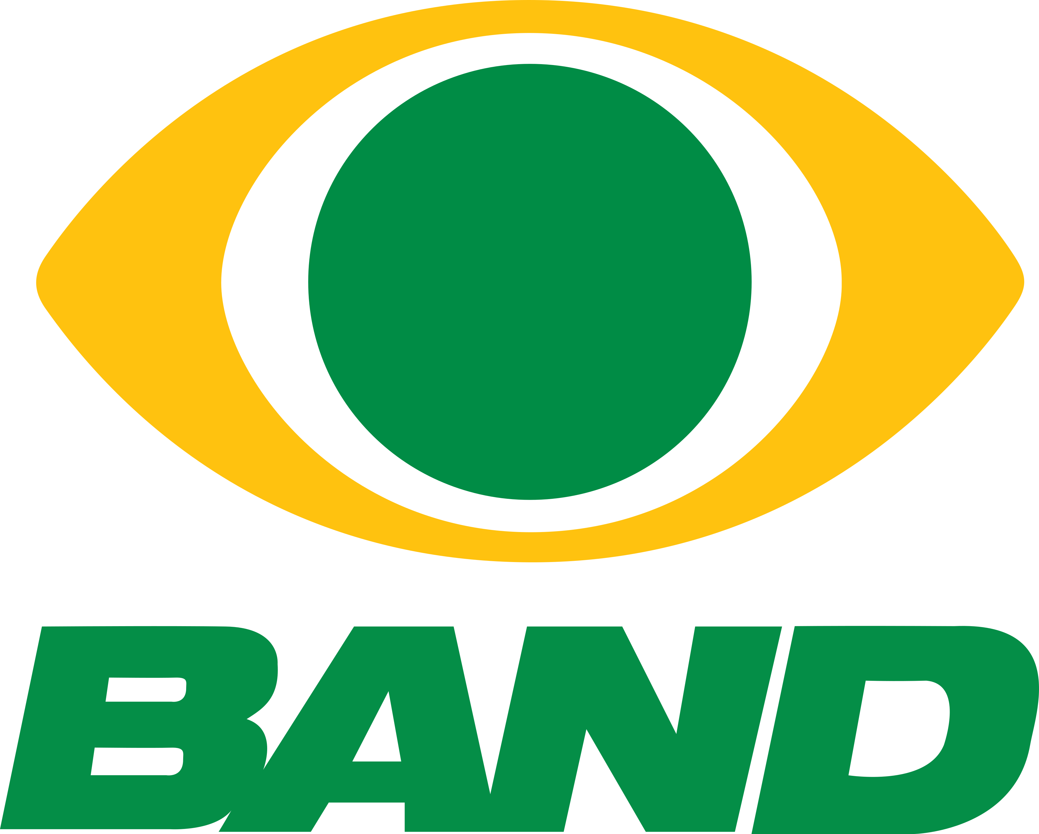 Band tira a maior estrela da Globo