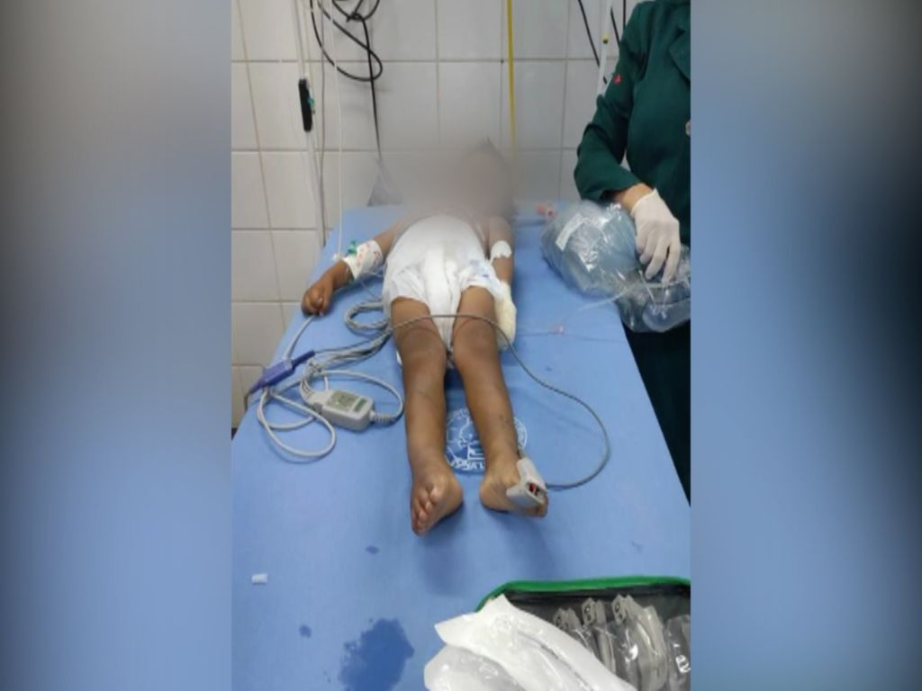 Morre criança de três anos agredida e queimada pelo próprio pai no AM