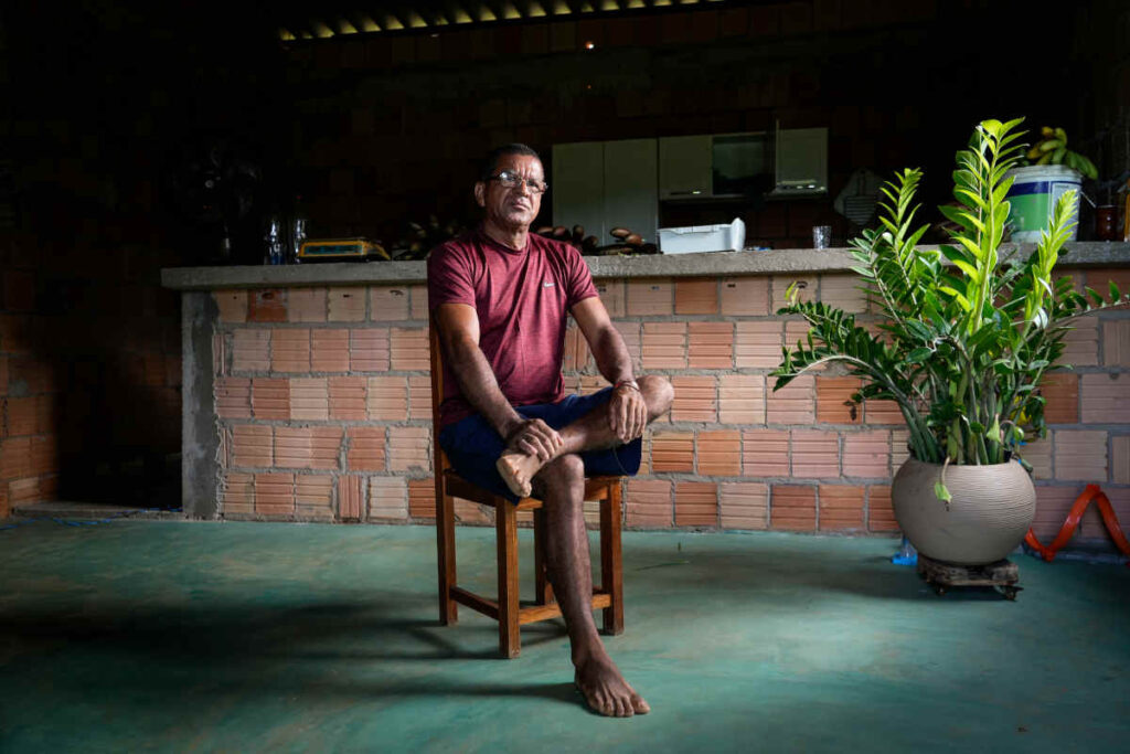 Massacre de Eldorado do Carajás: sobrevivente tem bala no olho há 30 anos